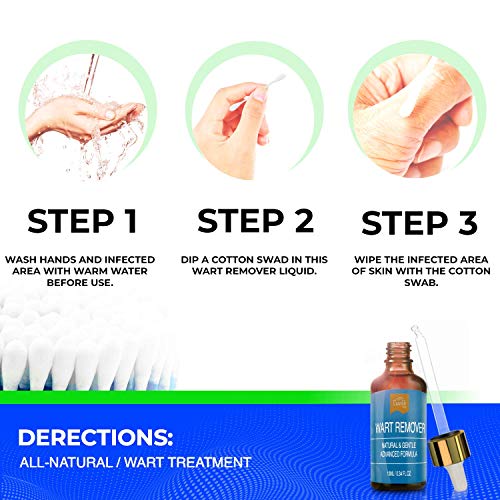Wart Remover Liquid Rapidly Eliminates Both Plantar and Common Warts, Papillo...