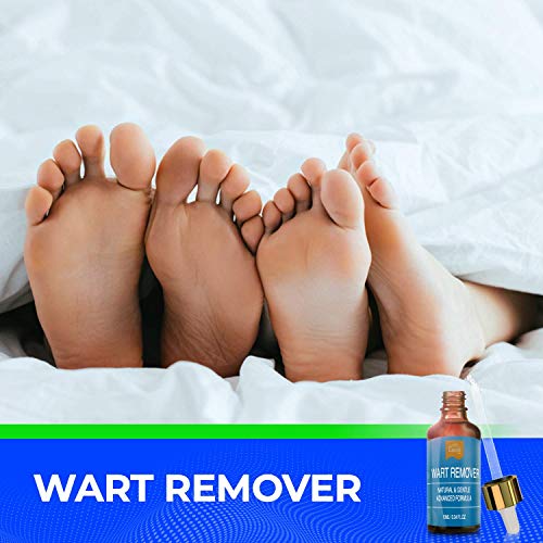 Wart Remover Liquid Rapidly Eliminates Both Plantar and Common Warts, Papillo...