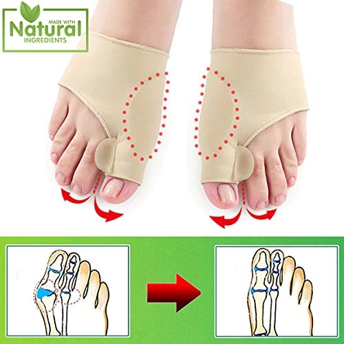 Bunion Corrector for Women Big Toe Straightener with Gel Pads | Bunion Protec...