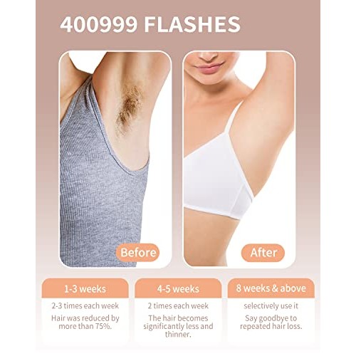 Laser Hair Removal, IPL Hair Removal Device, 7MAGIC Permanent Hair Removal fo...