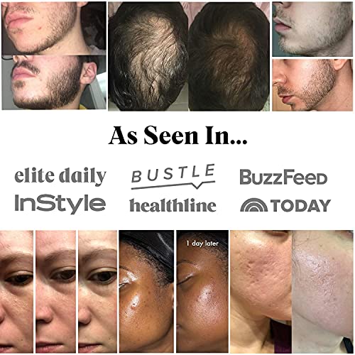 Derma Microneedle Roller Beard Growth for Men - 540 Titanium Microneedle Roll...