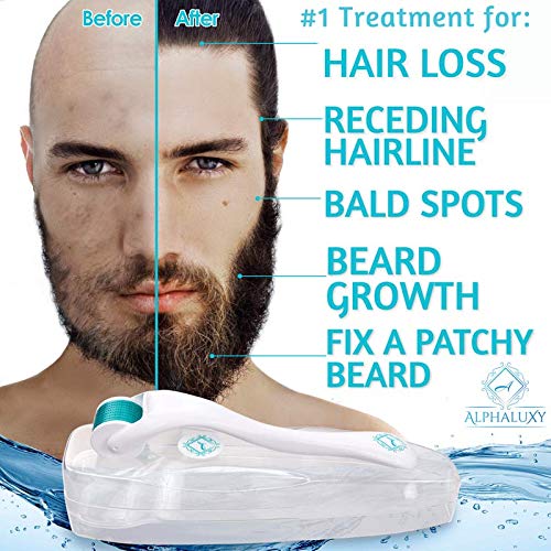 Derma Roller for Acne Scars, Hair Loss Treatment & Beard Growth - Microneedle...