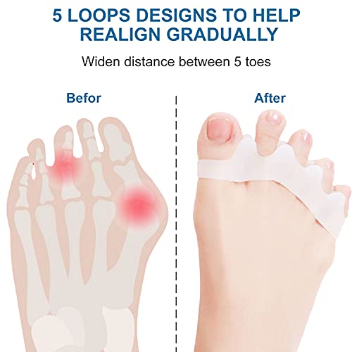 4 Pairs Toe Separator,Acecharming Gel Toe Stretcher for Overlapping Toes,Nail...