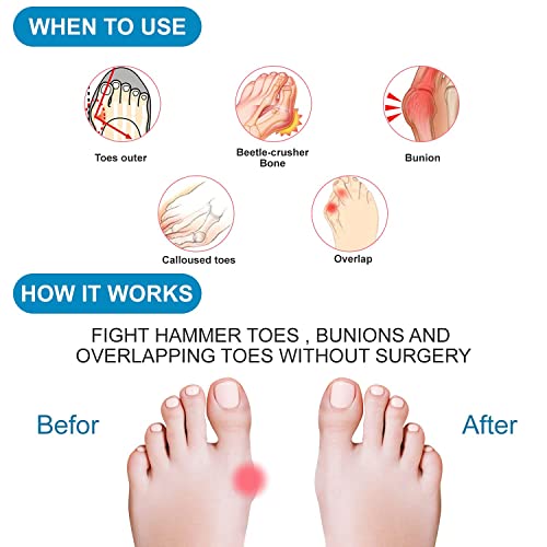 4 Pairs Toe Separator,Acecharming Gel Toe Stretcher for Overlapping Toes,Nail...