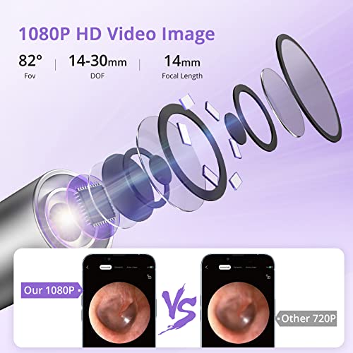 Ear Wax Removal Tool Camera, Acekool Ear Cleaner with 6 Pcs Ear Set, 1080P HD...