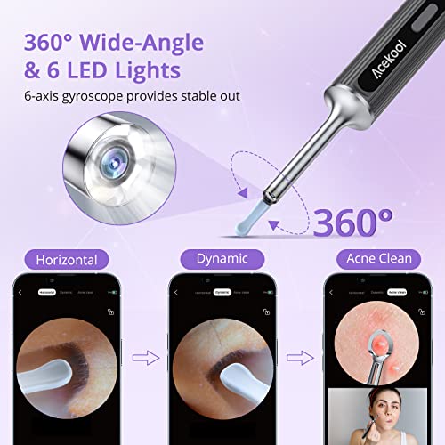 Ear Wax Removal Tool Camera, Acekool Ear Cleaner with 6 Pcs Ear Set, 1080P HD...