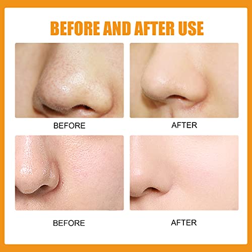 10 Pcs Mighty Nose Patch, Hydrocolloid Patches for Nose Pores Pimples Zits an...