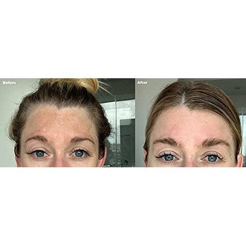 Admire My Skin Dark Spot Corrector Remover for Face - Brightening Serum Fade ...