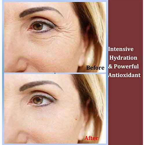 Under Eye Patches 24k Gold Under Eye Mask Puffy Eyes and Dark Circles Treatme...