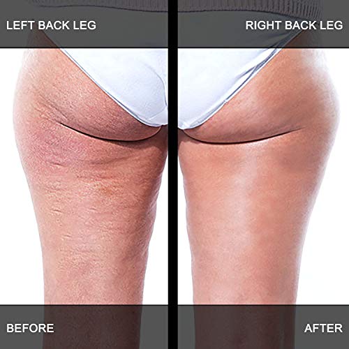 Adonia LegTone Serum - Organic Skin Tightening & Firming Cellulite Wrinkle Cr...