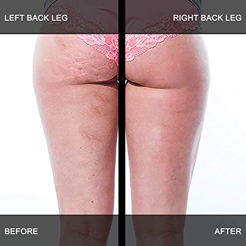 Adonia LegTone Serum - Organic Skin Tightening & Firming Cellulite Wrinkle Cr...