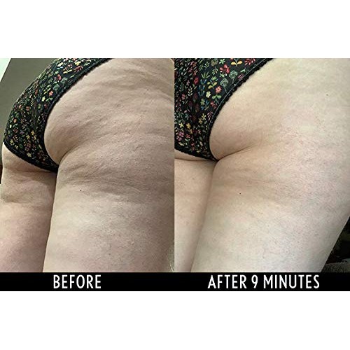 Adonia LegTone Serum - Organic Skin Tightening & Firming Cellulite Wrinkle Cr...