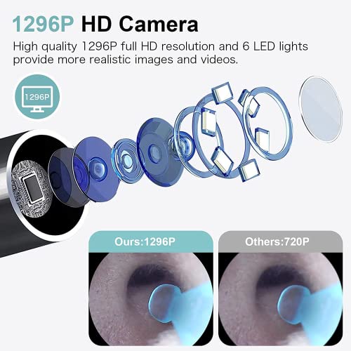 Ear Wax Removal, Ear Wax Remover Tool with 1296P HD Ear Cleaner Camera, 6 Low...