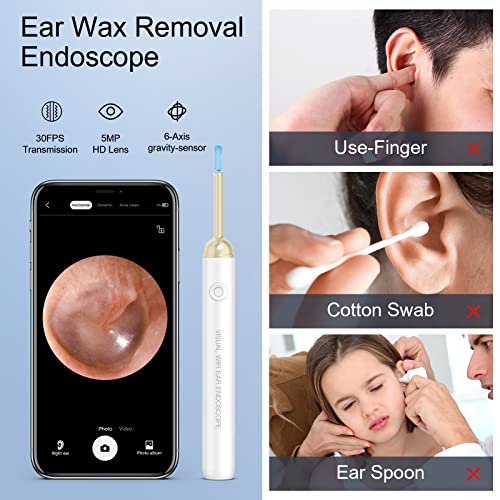 Ear Wax Removal Tool Camera, Wireless HD 1080P Ear Cleaner Endoscope with 3.5...