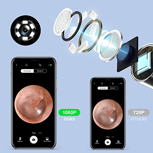 Ear Wax Removal Tool Camera, Wireless HD 1080P Ear Cleaner Endoscope with 3.5...