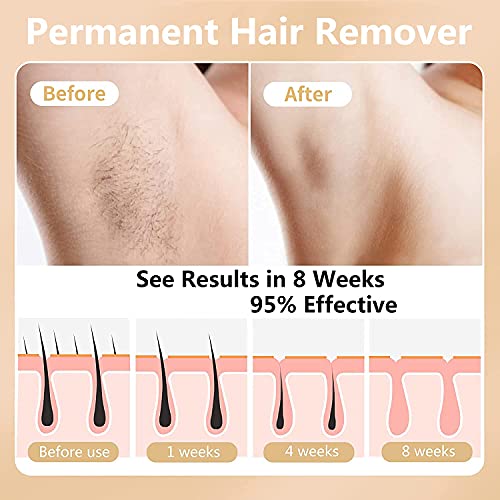 Hair Removal for Women Permanent Hair Removal Device 500,000 Flashes Painless...