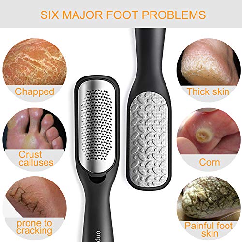 Foot File Callus Remover,Colossal Foot Rasp and Professional Foot Scrubber Pe...
