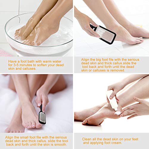 Foot File Callus Remover,Colossal Foot Rasp and Professional Foot Scrubber Pe...