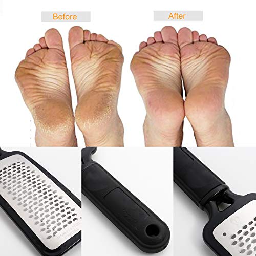 Foot File Callus Remover,Colossal Foot Rasp and Professional Foot Scrubber Pe...