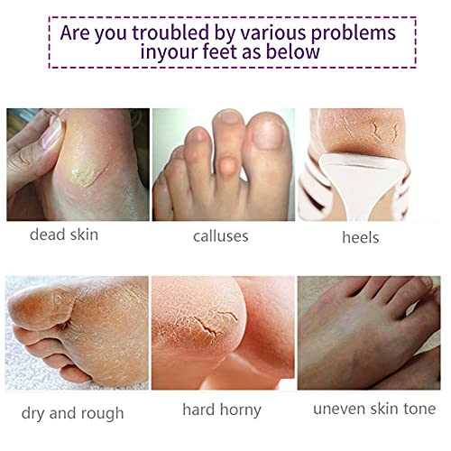 Foot Peel Mask 5 Pack, Lavender Exfoliating Foot Masks, Baby Foot Peel Soft S...