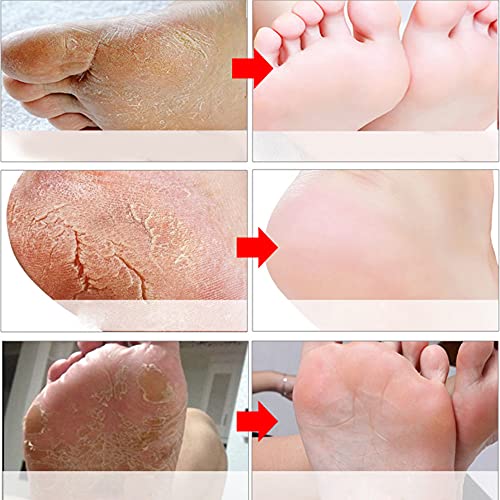 Foot Peel Mask 5 Pack, Lavender Exfoliating Foot Masks, Baby Foot Peel Soft S...