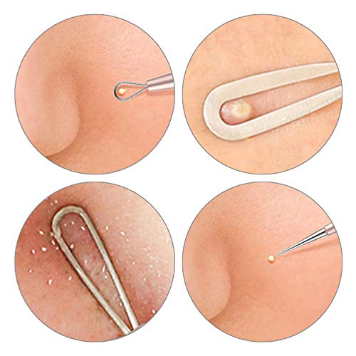 Blackhead remover,Acne treatment,Pimple Popper,Face Skin Care Kit,Professiona...