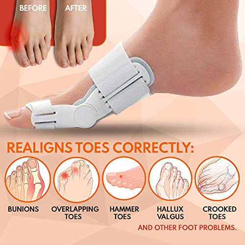 Bunion Corrector and Bunion Relief Orthopedic Bunion Splint Pads for Men and ...