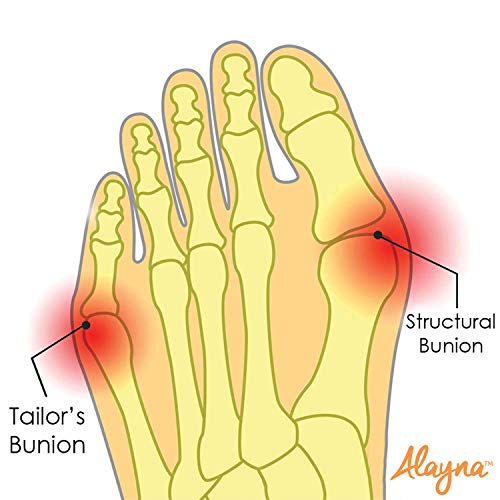 Bunion Corrector with Non-Slip Grip Insert and Gel Cushion Pad Splint Orthope...