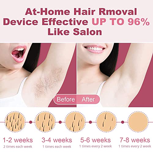 Alcyoneus IPL Hair Removal for Women Permanent, At-Home Laser Hair Removal De...