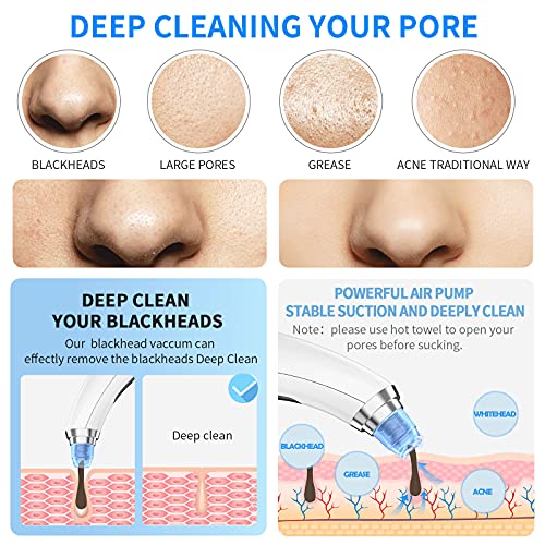 Blackhead Remover Vacuum Blackhead removal tool Blackhead Vacuum,USB Recharge...