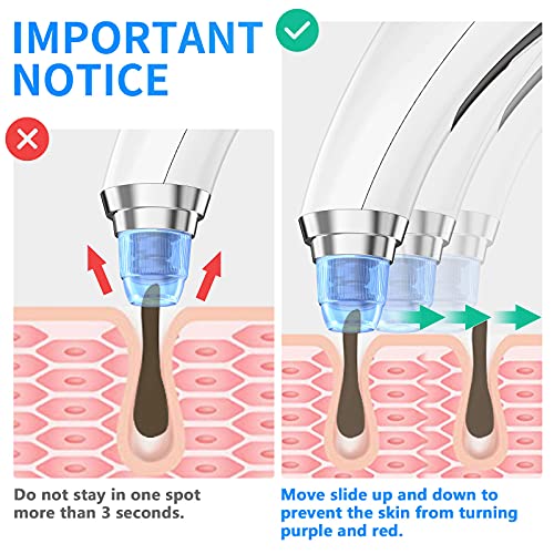 Blackhead Remover Vacuum Blackhead removal tool Blackhead Vacuum,USB Recharge...