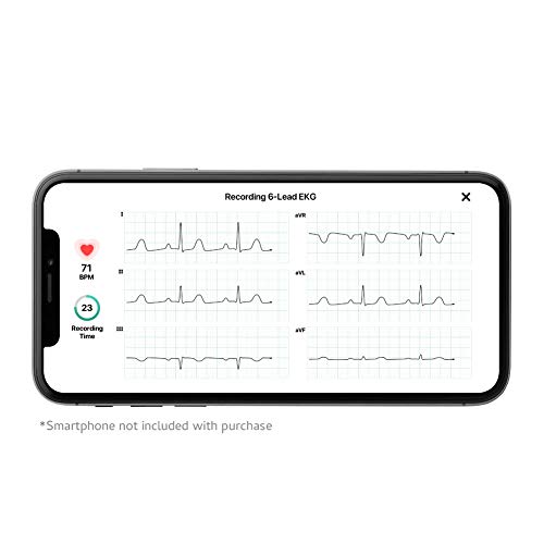 KardiaMobile 6L Personal EKG Device and Heart Monitor - 6 Lead EKG - 3 Arrhyt...