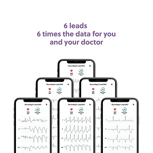 KardiaMobile Six-Lead Personal EKG Device - Record EKGs at Home and Detect Ir...