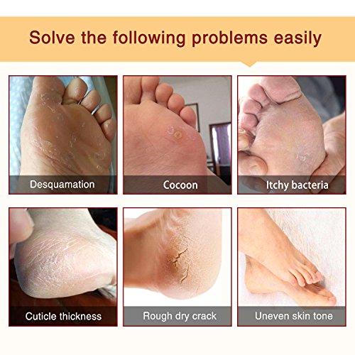 Foot Peel Mask 3 Pack， Exfoliator Peel Off Calluses Dead Skin Callus Remover...
