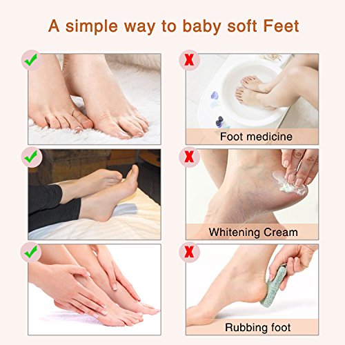 Foot Peel Mask 3 Pack， Exfoliator Peel Off Calluses Dead Skin Callus Remover...