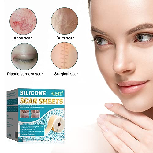 Silicone Scar Tape, Medical Soft Silicone Scar Sheets for Scar Removal, Silic...