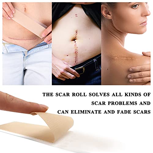 Silicone Scar Tape, Medical Soft Silicone Scar Sheets for Scar Removal, Silic...