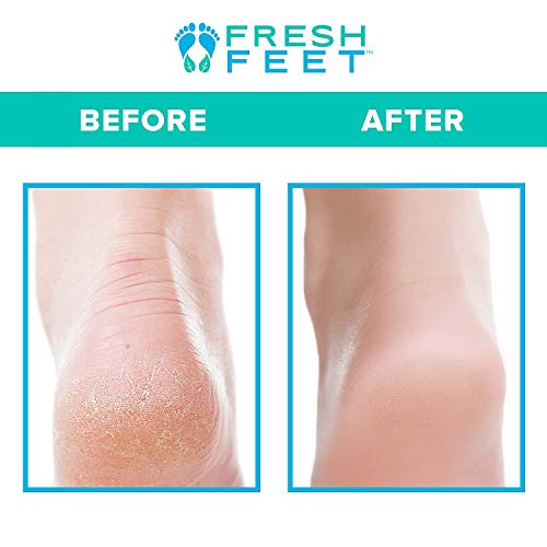 Fresh Feet- Foot Scrubber With Pumice Stone, Cleans, Smooths, Exfoliates & Ma...