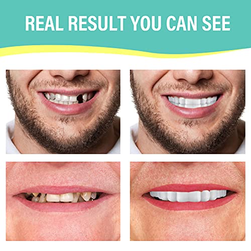 3 PCS Fake Teeth, Dentures Teeth for Upper and Lower Jaw, Nature and Comforta...