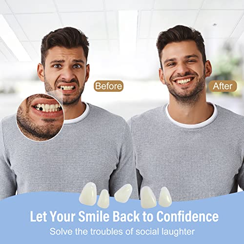 Fake Teeth, Tooth Repair Kit for Temporary Fixing The Missing and Broken Toot...