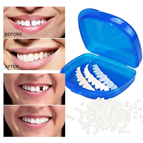 Tooth Repair Kit,Fake Teeth for Temporary Fixing The Missing and Broken Tooth...