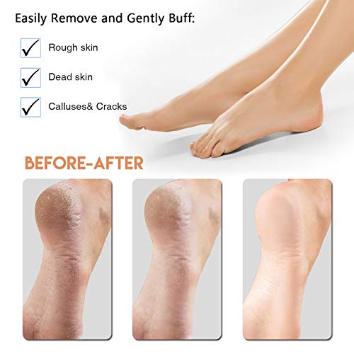 Foot Scraper Pedicure Foot File, Professional Foot Rasp File Foot Scrubber, P...