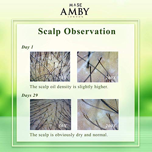 Amby London Degrease Shampoo For Oily Hair Women Men - Smelly Scalp Shampoo F...