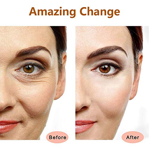 Face Massager Roller Golden Electric 3D Roller and T Shape Facial Massager Ki...