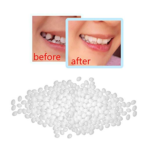 Temporary Tooth Repair Kit-Teeth Repair Kit, Thermal Beads for Filling Fix Th...