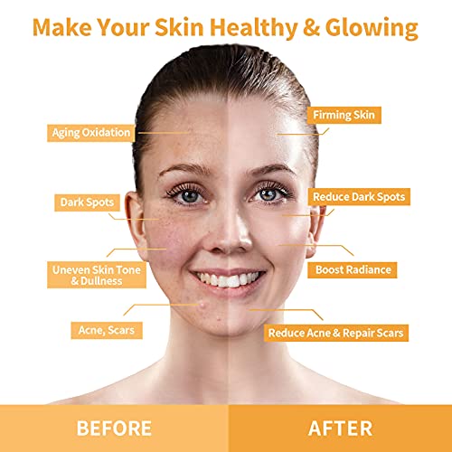 ANAIRUI Turmeric Vitamin C Face Mask, Clay Facial Mask with Vitamin C E for R...