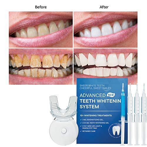 AngelicMisto Teeth Whitening Kit, 5 Min Non-Sensitive Fast Teeth Whitener wit...