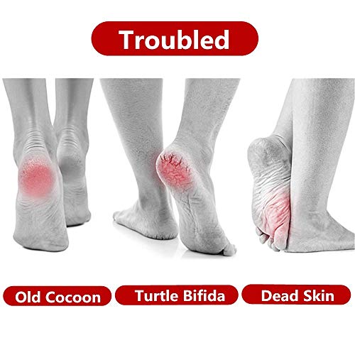 Aniso Foot Care Pedicure Callus Shaver Hard Skin Remover，Surgical Grade Stai...