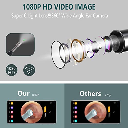 Earwax Removal Kit with 1080P HD, Ear Camera Ear Wax Removal Tool with WiFi 6...