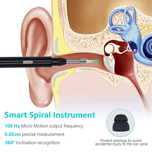 Earwax Removal Kit with 1080P HD, Ear Camera Ear Wax Removal Tool with WiFi 6...